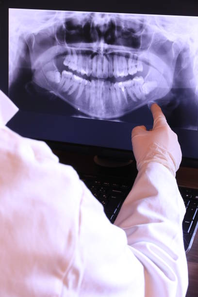 Best Emergency Root Canal Treatment in Ocean Pines, MD