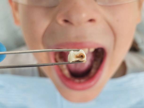 Best Orthodontic Emergency Dentist in Ocean Pines, MD